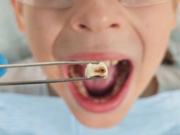 Best Emergency TMJ Treatment in Newkirk, OK