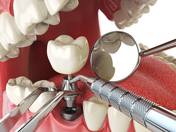Best Emergency Treatment for Dental Infections or Abscesses in Newkirk, OK